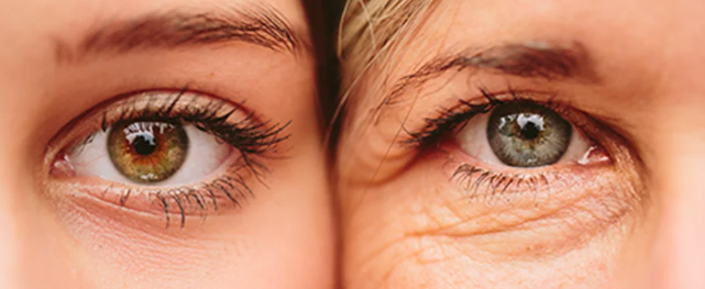 Close-up of two female eyes at different life stages showing natural changes in eye appearance over time